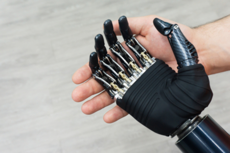 robotic prosthetic hand in human hand